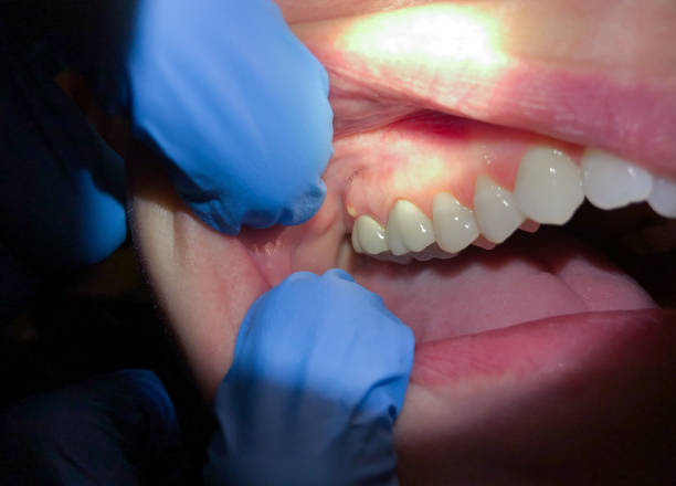 Best Emergency Dental Surgery in Richardson, TX